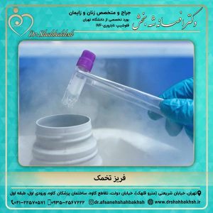 فریز تخمک