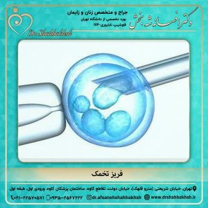 فریز تخمک