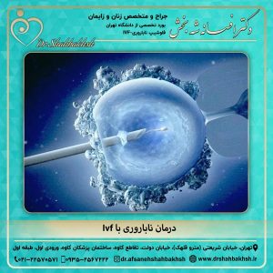 درمان ناباروری با Ivf