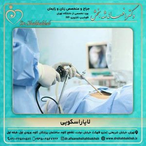 لاپاراسکوپی