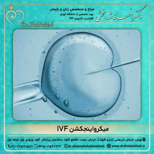 میکرواینجکشن IVF