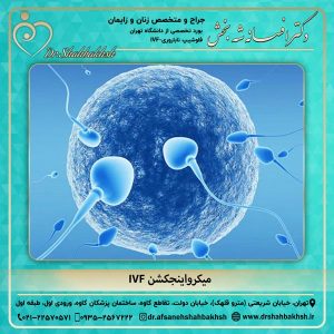 میکرواینجکشن IVF