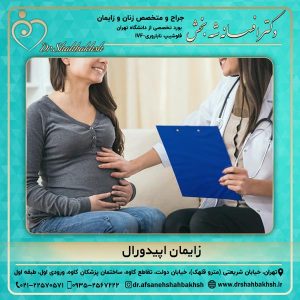 زایمان اپیدورال