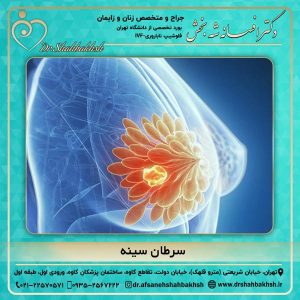 سرطان سینه 