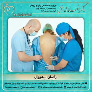 زایمان اپیدورال