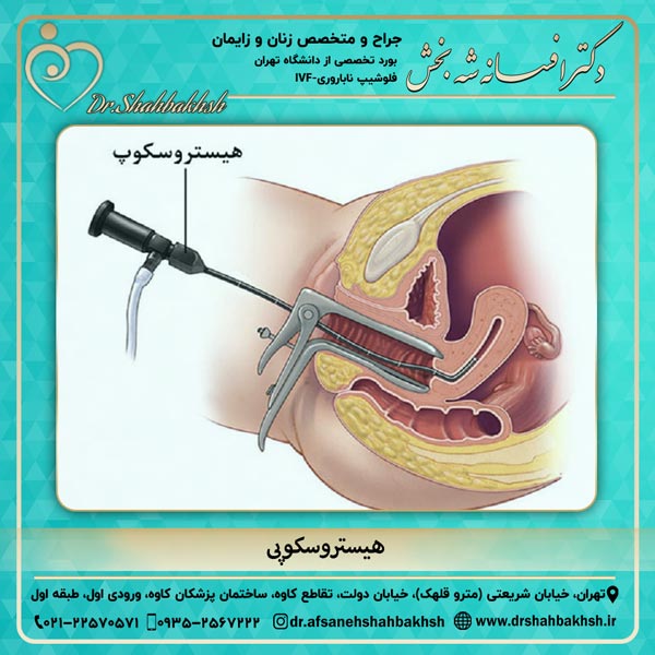 هیستروسکوپی روشی برای درمان ناباروری