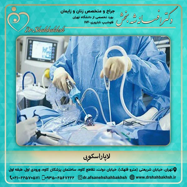 لاپاراسکوپی