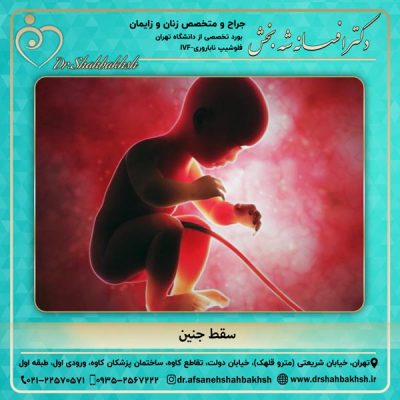 سقط جنین - دکتر شه بخش