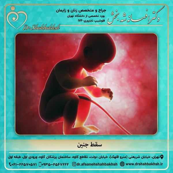 سقط جنین
