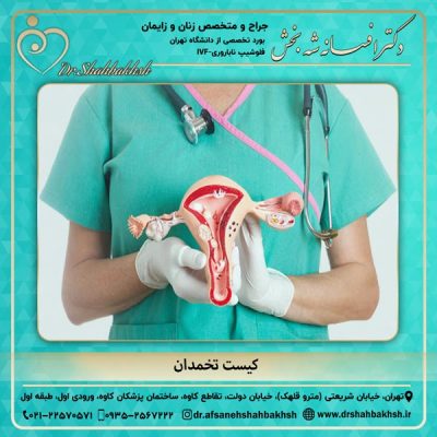 کیست تخمدان - دکتر شه بخش