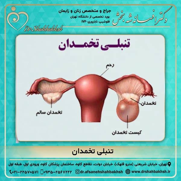 تنبلی تخمدان