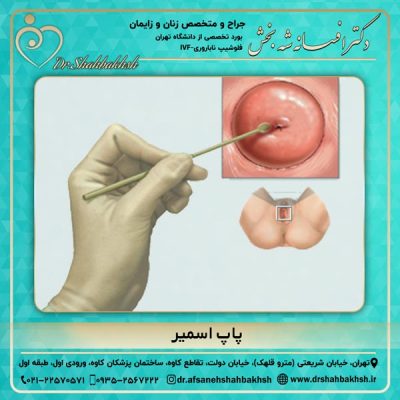 پاپ اسمیر - دکتر شه بخش