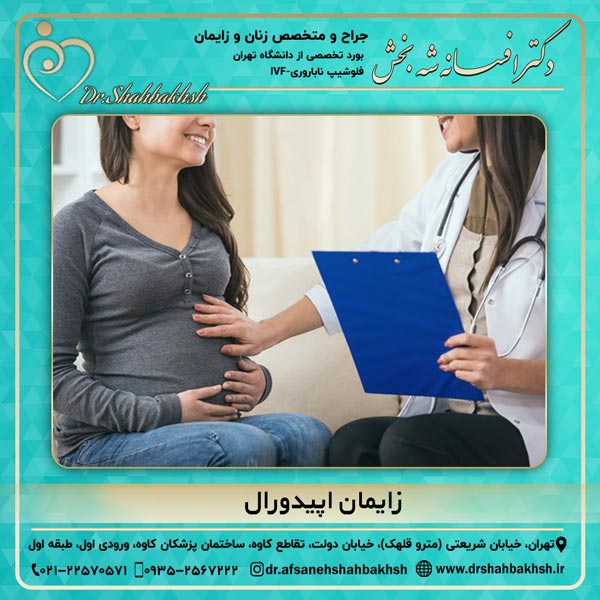 زایمان اپیدورال